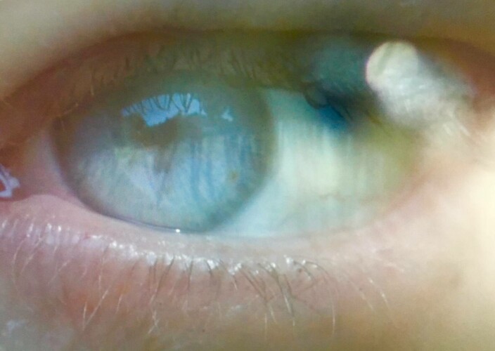 Absence reciprocity zranitelnosti, ztrát i rizik